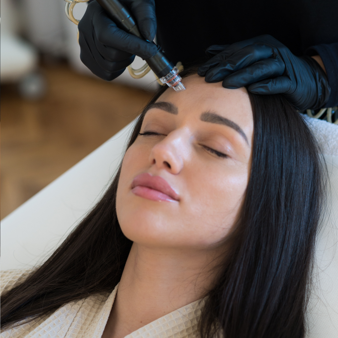 Roses VIP Bella Hydrafacial