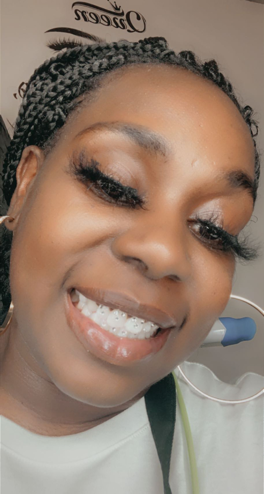 Tooth Gems