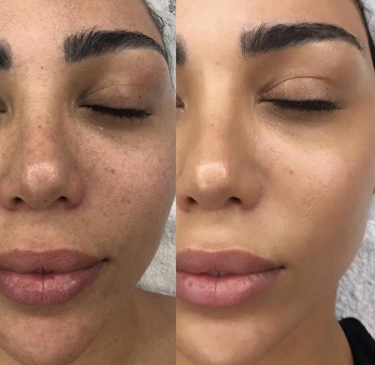 BB Glow Facial at Angela Artistry in Plant City, FL