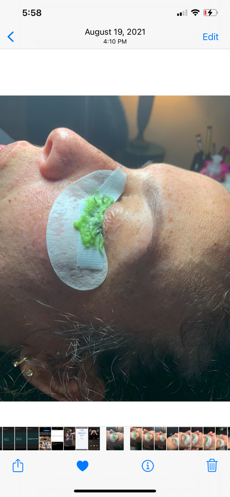 Lash Removal