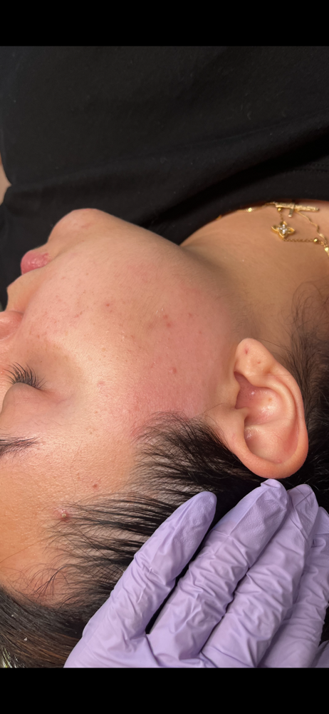 Sideburn Wax at Desthetics Beauty in Bronx, NY