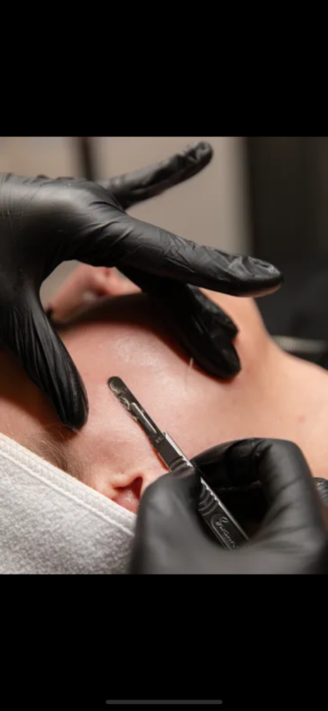 The Deluxe Dermaplane