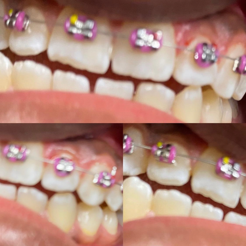Color Change Only