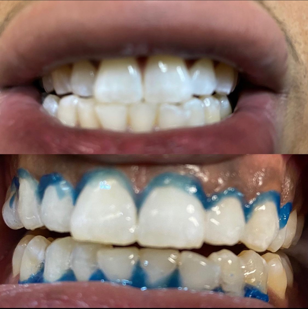 Deep Cleaning Standard