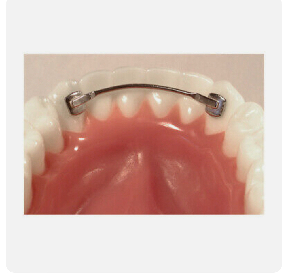 Permanent Retainer