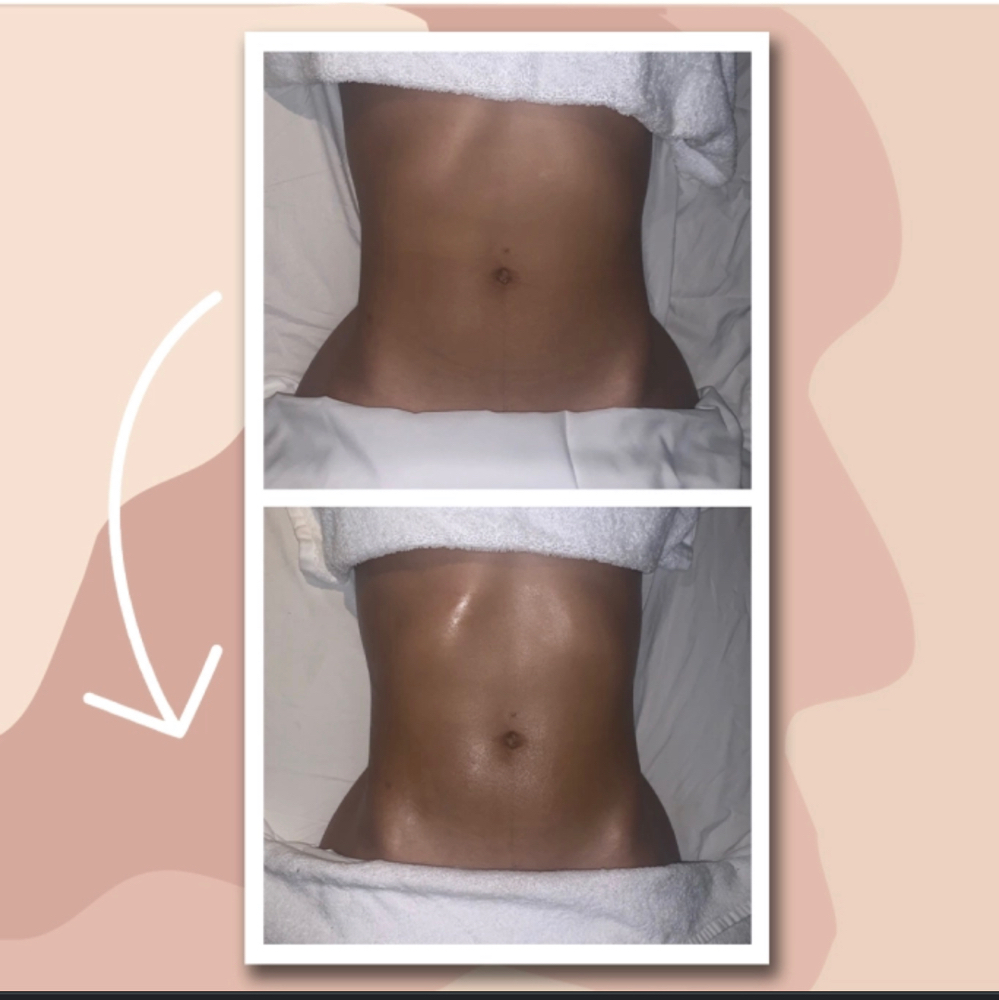 Lymphatic Massage