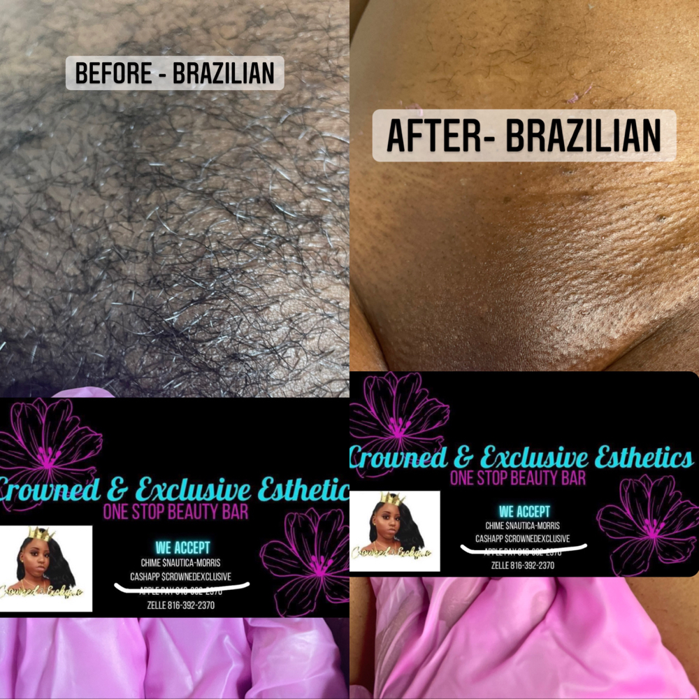 Brazilian Hair Removal at Crowned Exclusive Esthetics in Kansas City, MO
