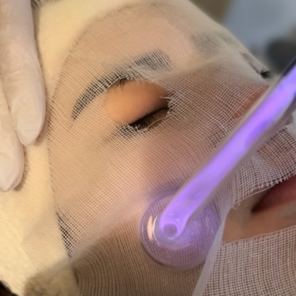High Frequency Add On at Uncommon Esthetics in Rancho Cucamonga, CA