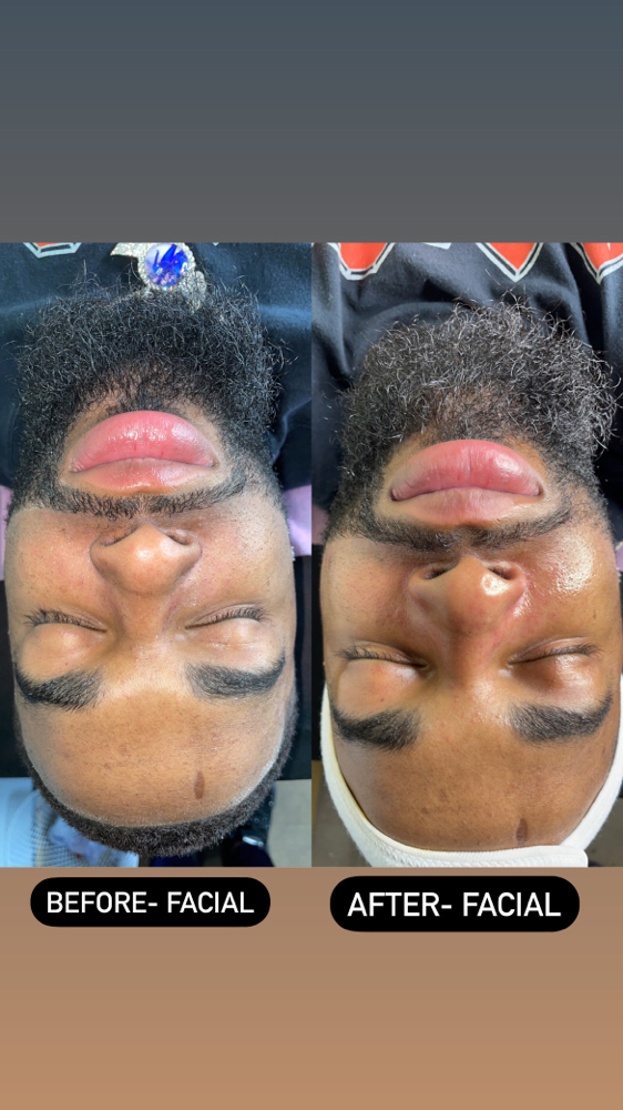 Crowned Facial at Crowned Exclusive Esthetics in Kansas City, MO