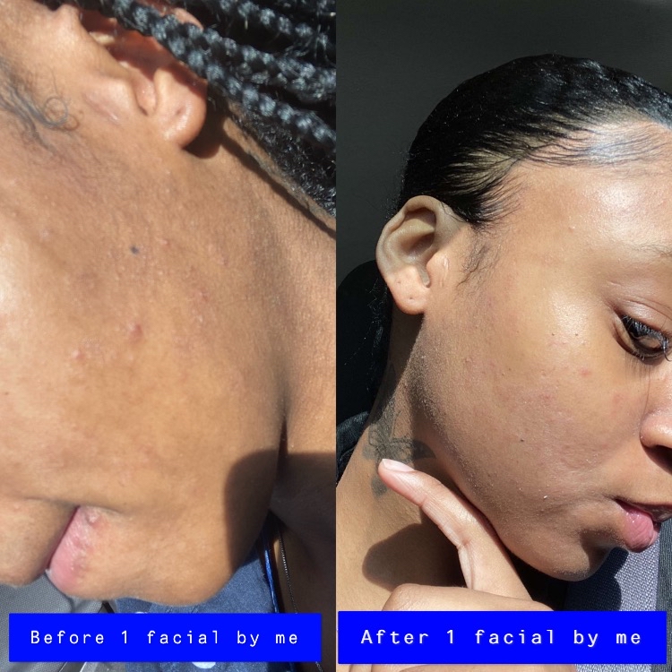 Fancy Facials at Crowned Exclusive Esthetics in Kansas City, MO