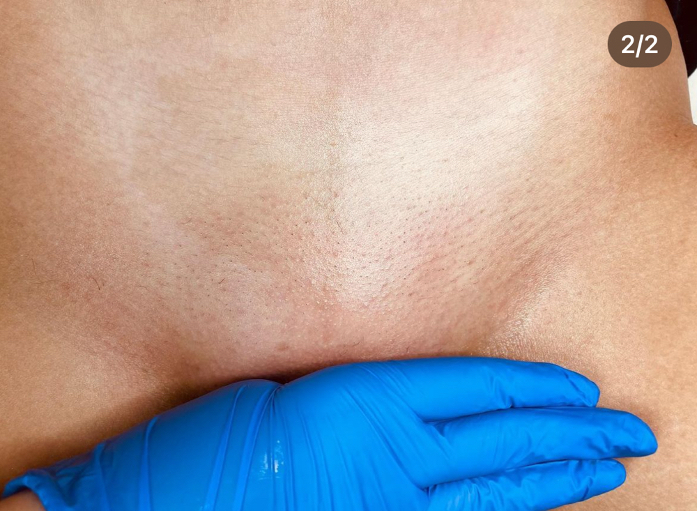 Bikini Line Wax