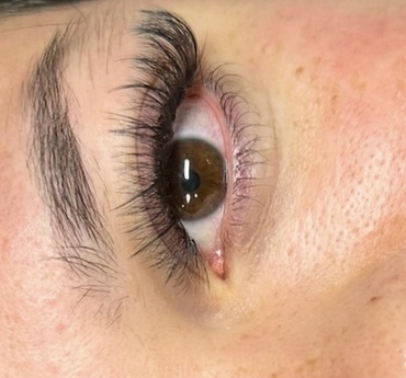Hybrid Fill