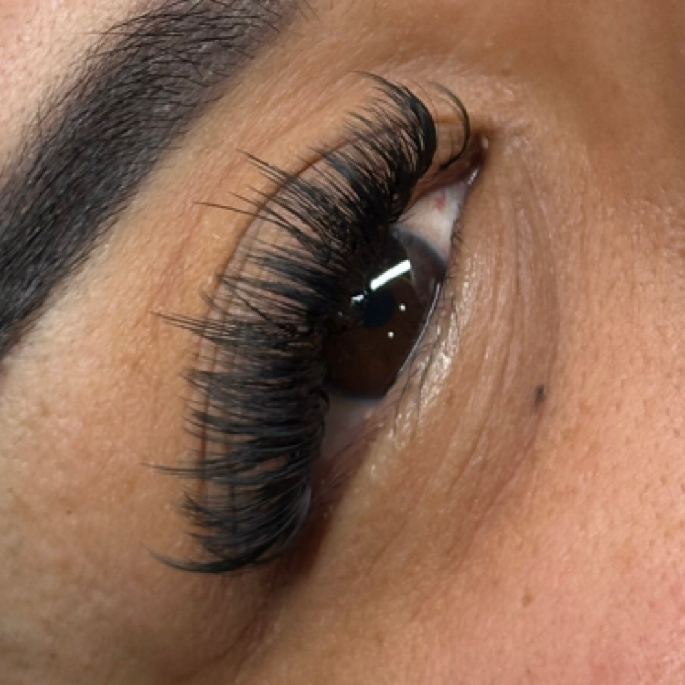 Hybrid Fill at Ady Esthetics in San Diego, CA