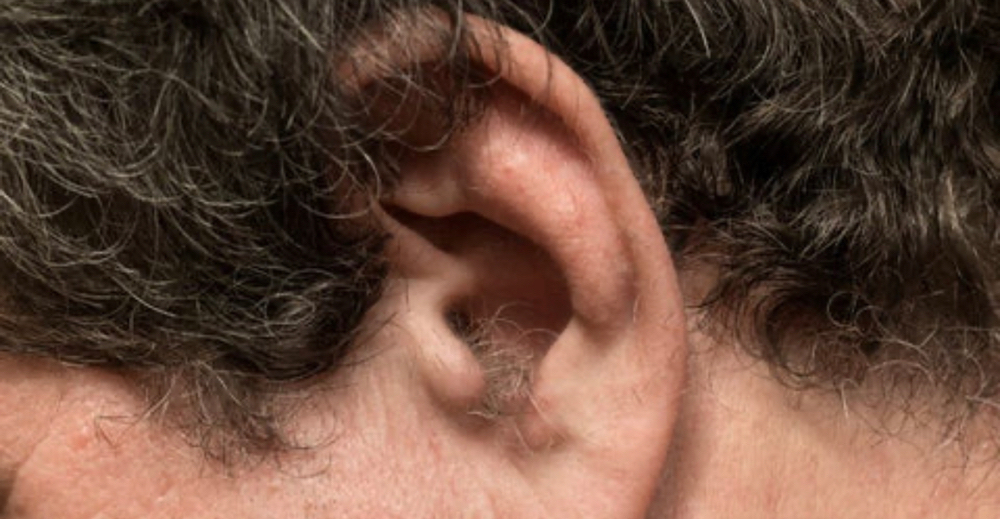 Ear Wax