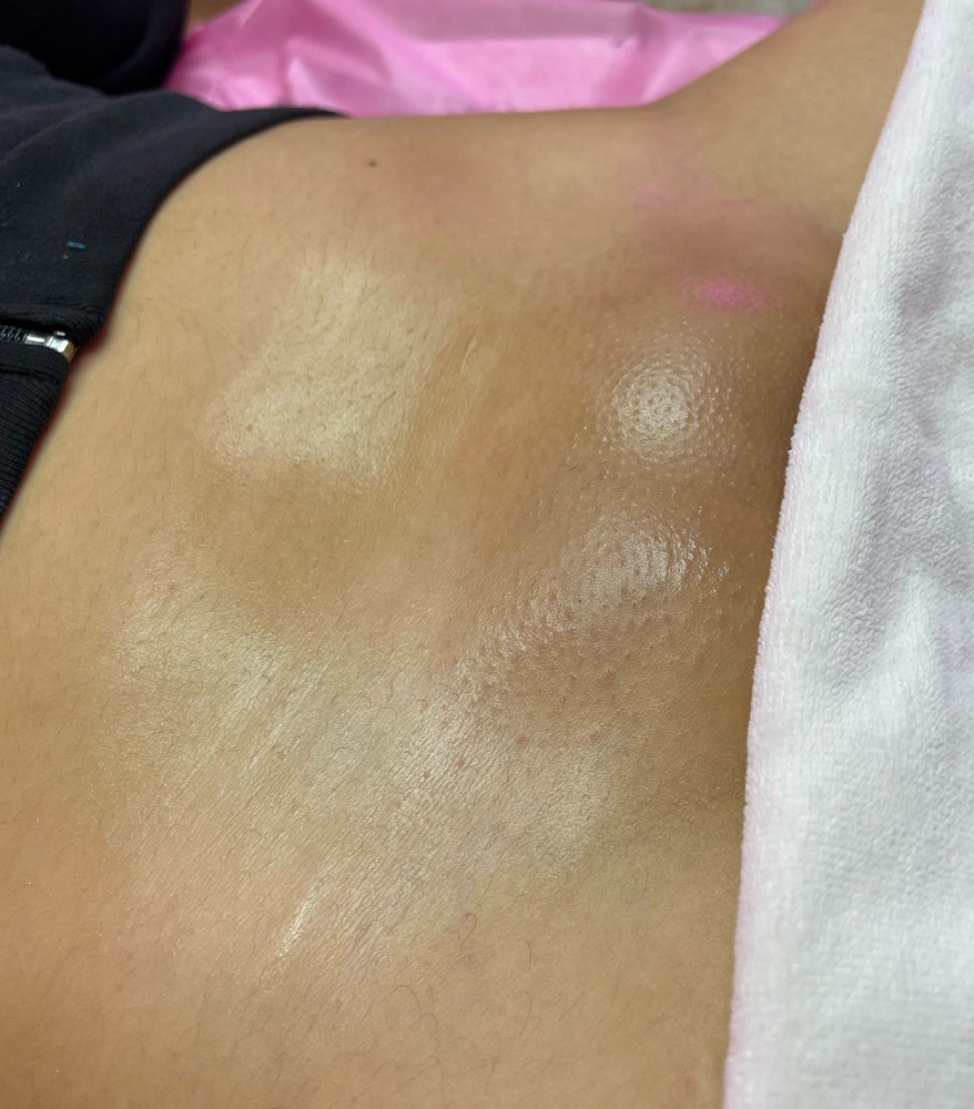 Brazilian Wax / Sugaring + Vajacial