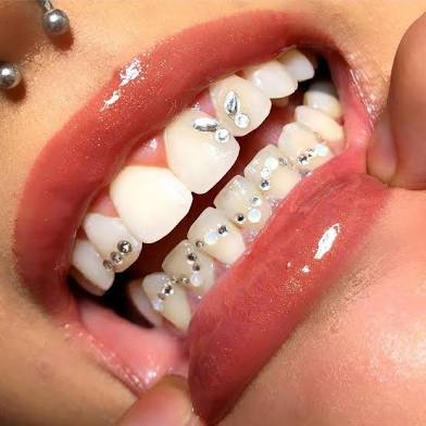 Tooth Gems