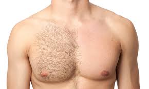 Waxing: Chest Wax