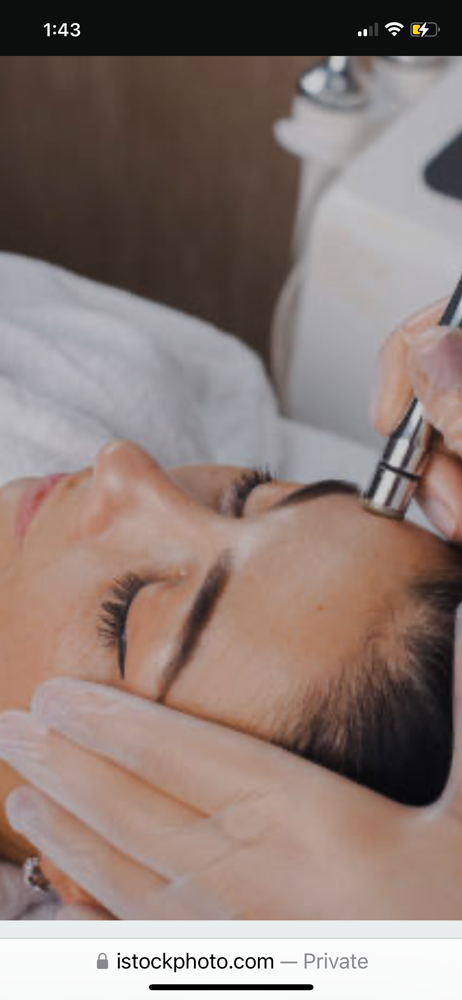 Micro Dermabrasion Split Package