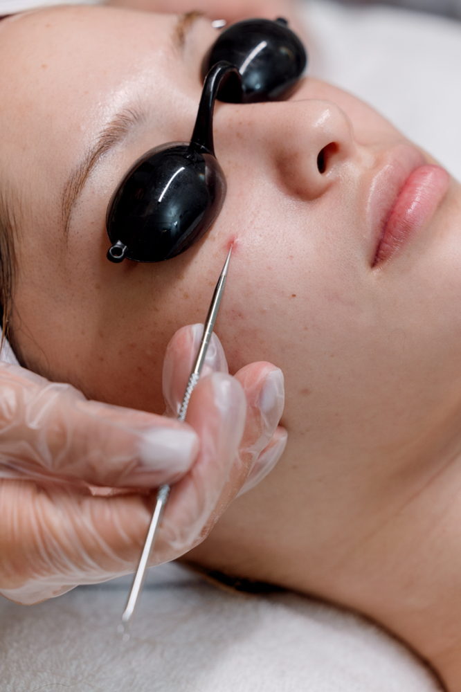 Sensitive Skin Facial