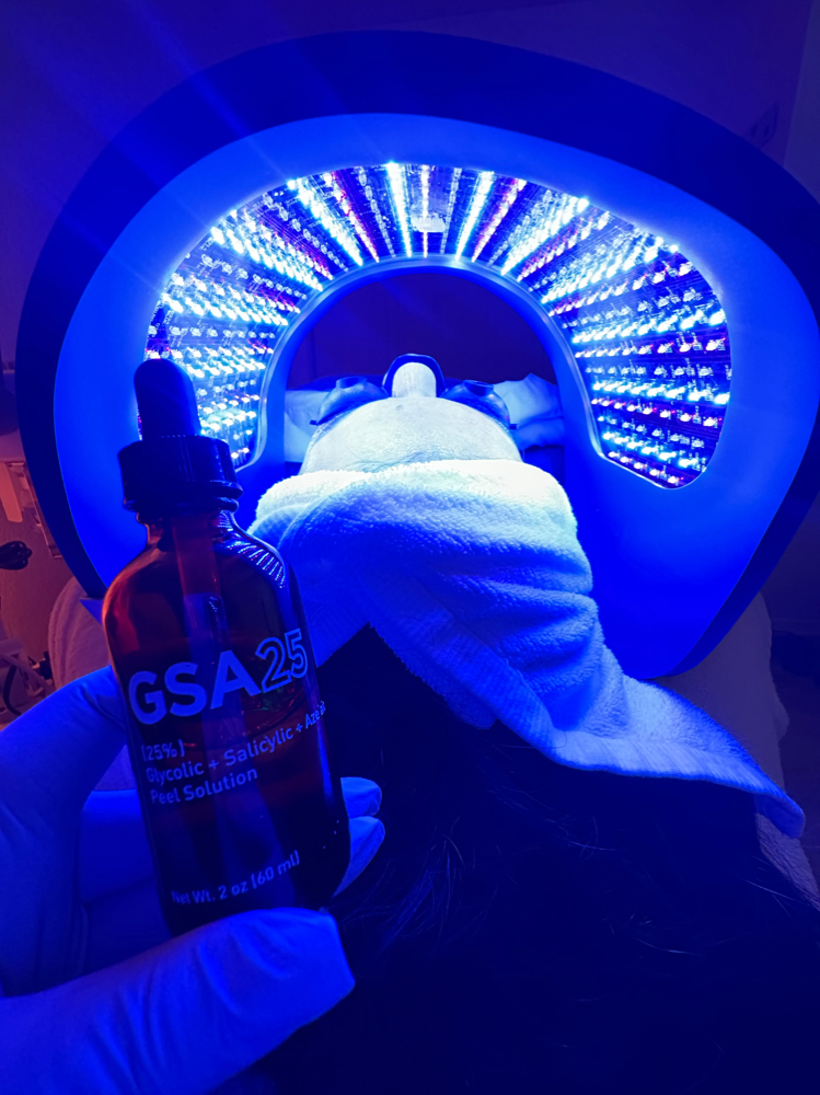 Anti Aging Chemical Peel