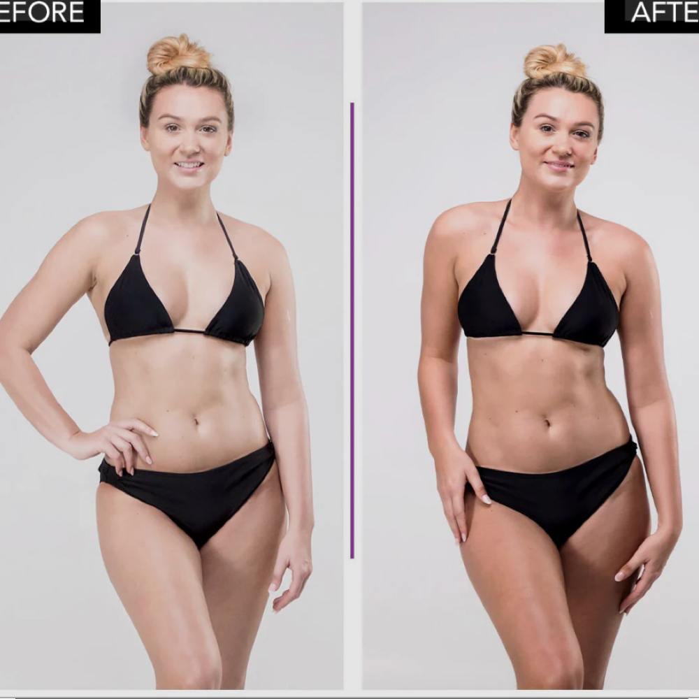 Rapid Sunless Spray Tan at Wave Wellness & Aesthetics RBNY in Belle harbor, NY