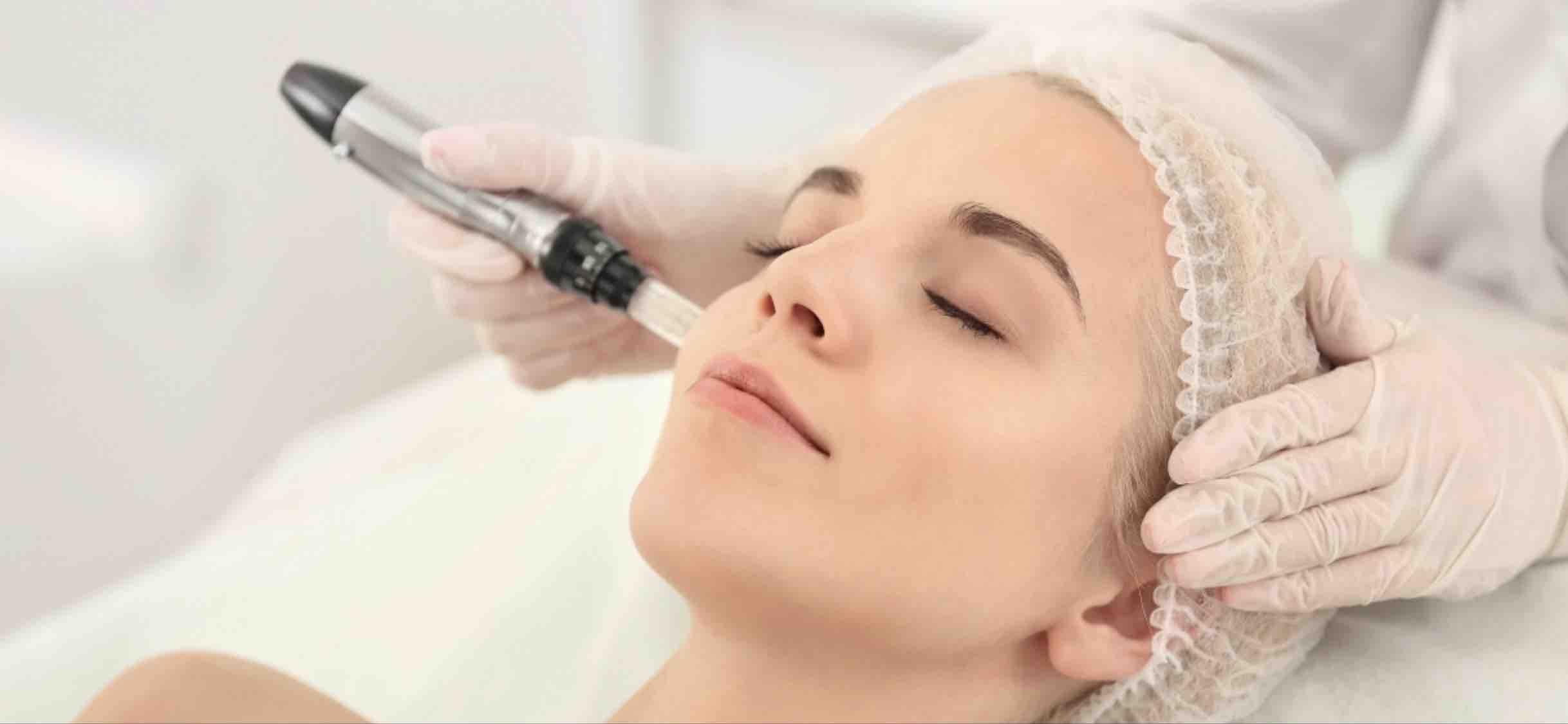 Microneedling