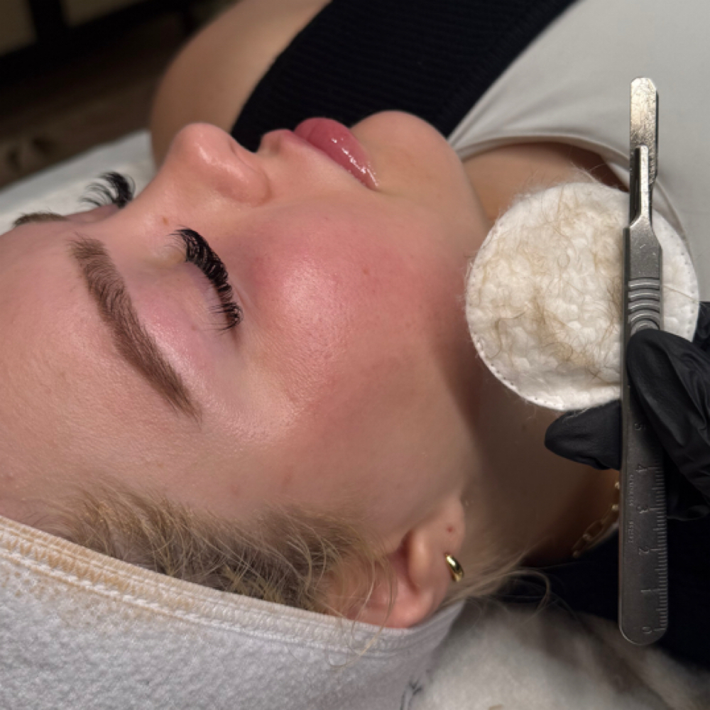 Express Dermaplaning at Caroline Ply Esthetics in Little Rock, AR