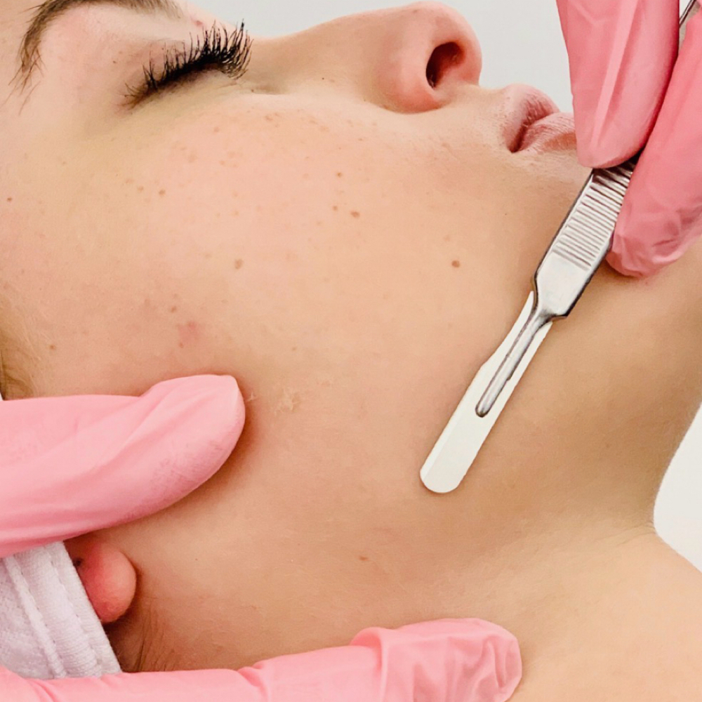 Dermaplane Add On at Skin Ritual Studio in San Antonio, TX