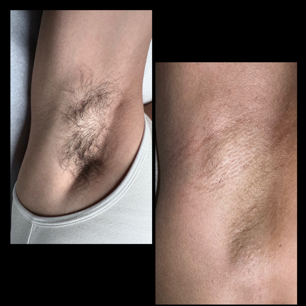 Underarm wax