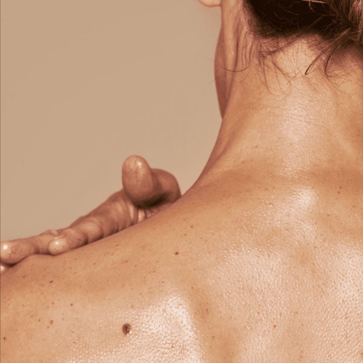 Body Chemical Peel at KNR Aesthetics in Brandon, FL