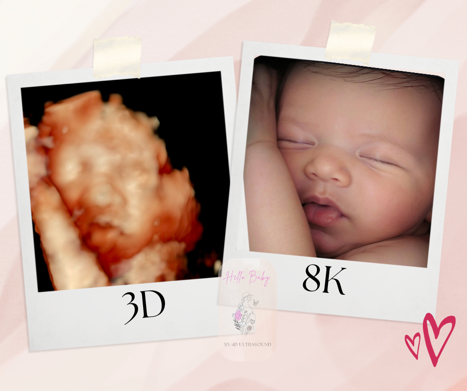 8K [ADD -ON Service] at HELLO BABY 3D/4D LLC in Deer Park, TX