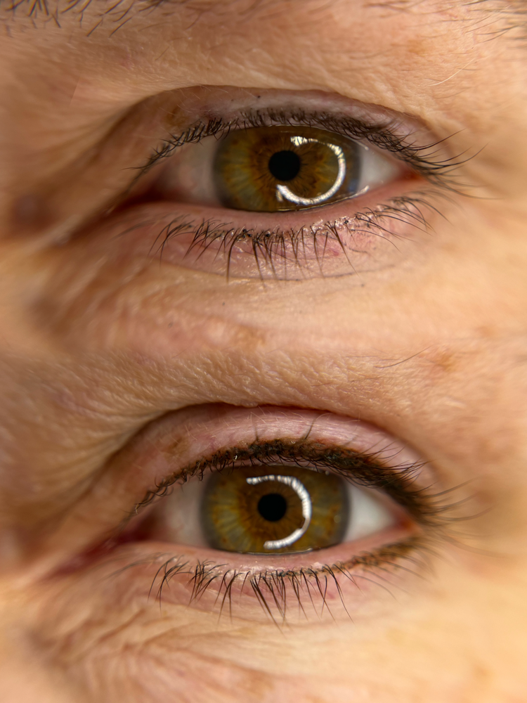 Lash Line Enhancement