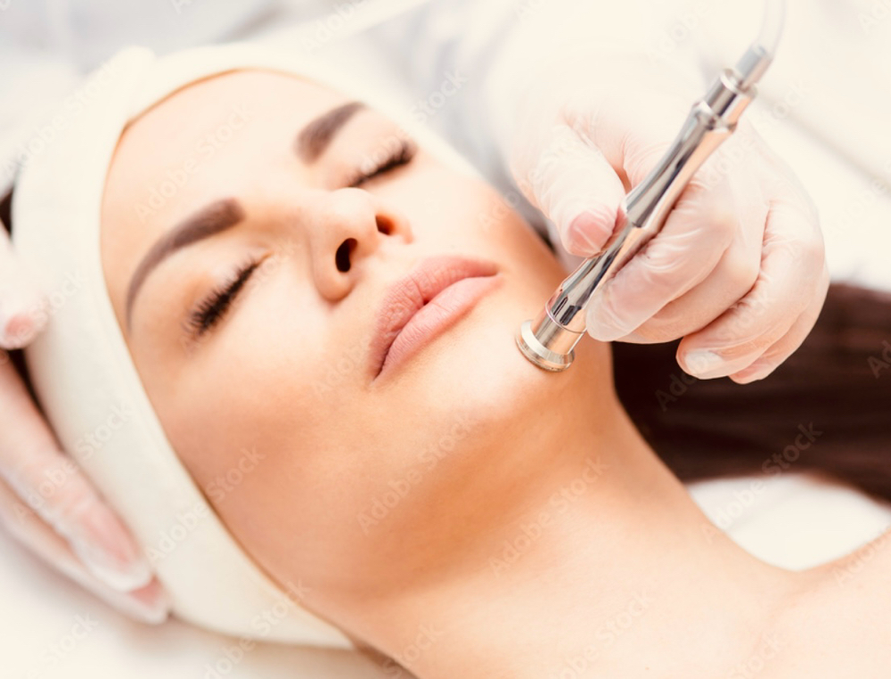MAY SPECIAL 4 Microderm Sessions