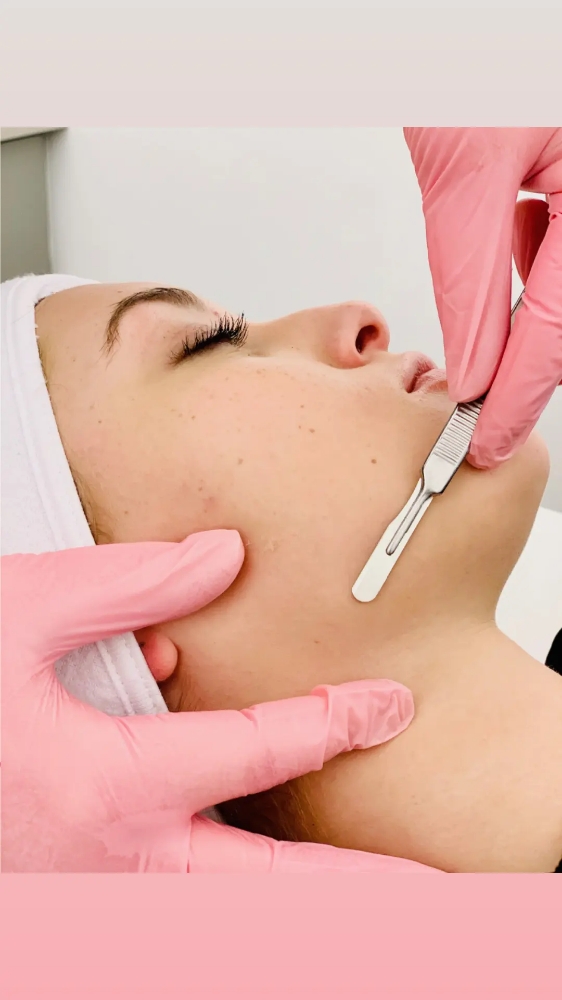 Custom Dermaplane Facial