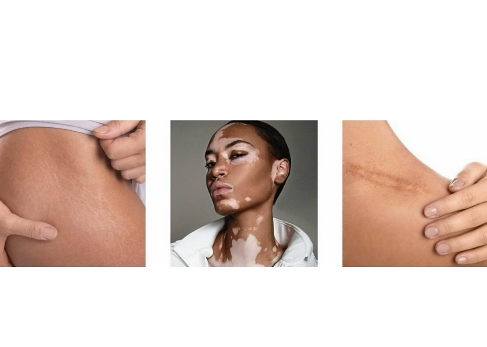 Free Consult- Camoflauge Service