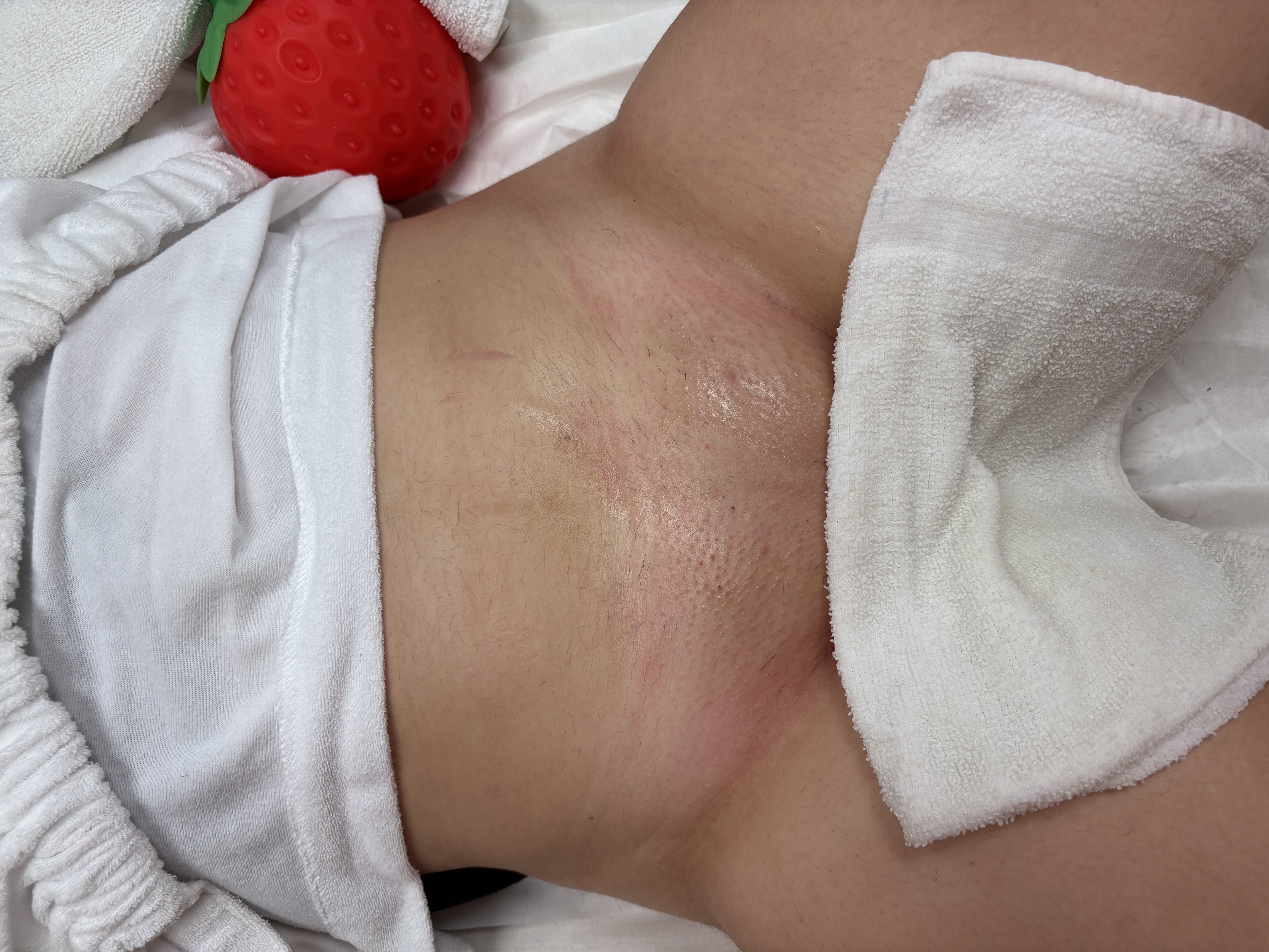Brazilian Wax