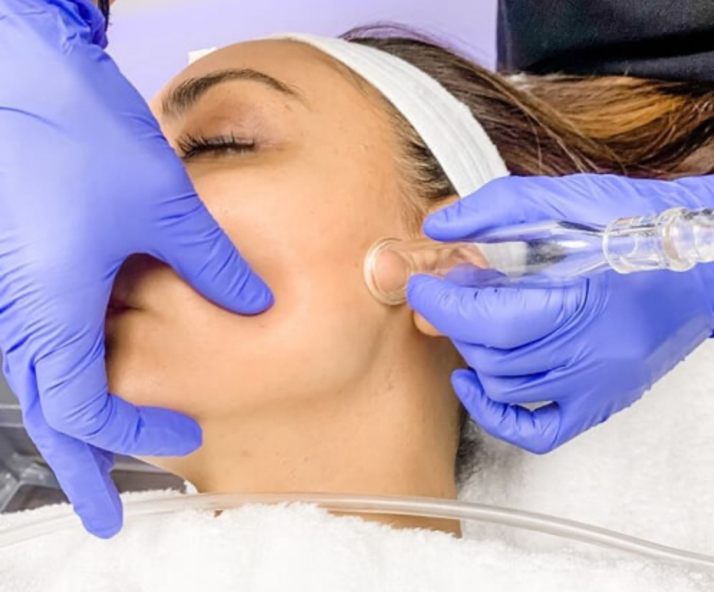 HYDRAFACIAL™ Lymphatic Therapy