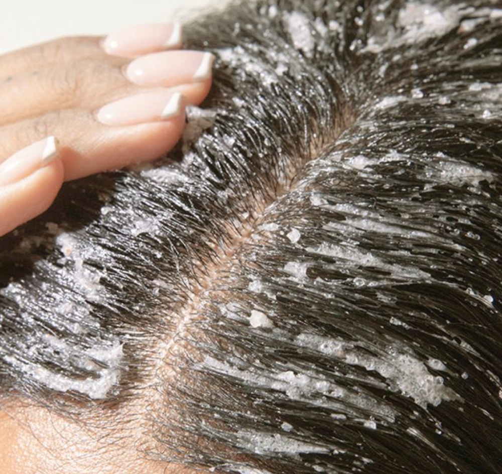 Luxury Scalp Treatment