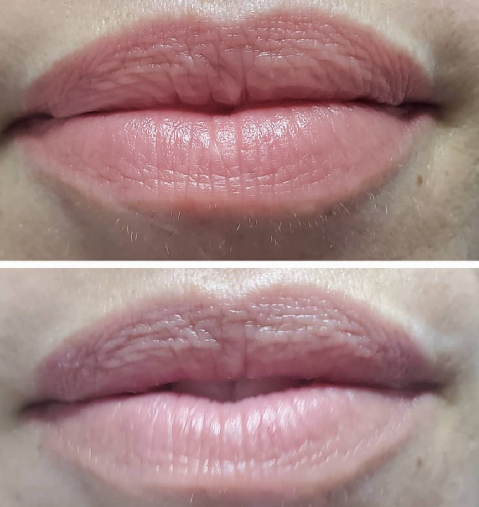 3D KOREAN BOOSTER LIPS at Mily Gerig Skincare Glow LLC in Lincoln, RI