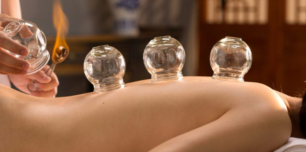 Fire Cupping  Add On at Aurum Sanctum in St. Louis Park, MN