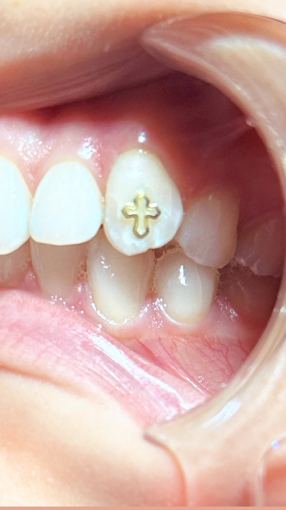 14k Gold Or Silver Tooth Gem