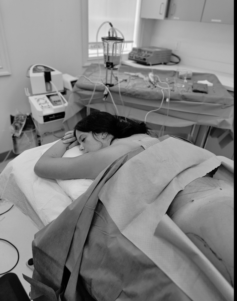 Post Op Manual Lymphatic Drainage