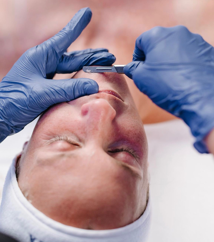 Dermaplane Facial
