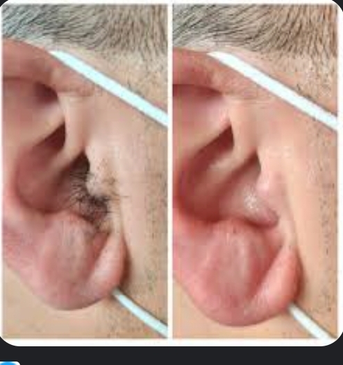 Ear Waxing