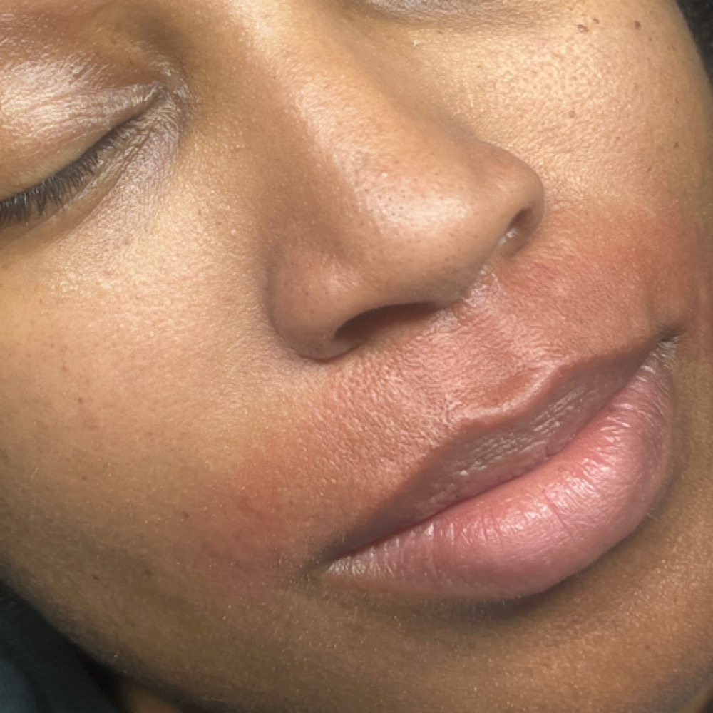 Lip Wax at Radiant Eyes & Aesthetics in Petal, MS