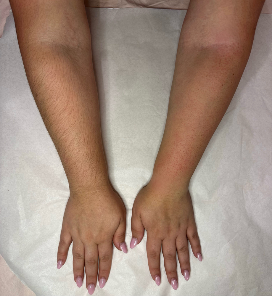 Arm wax