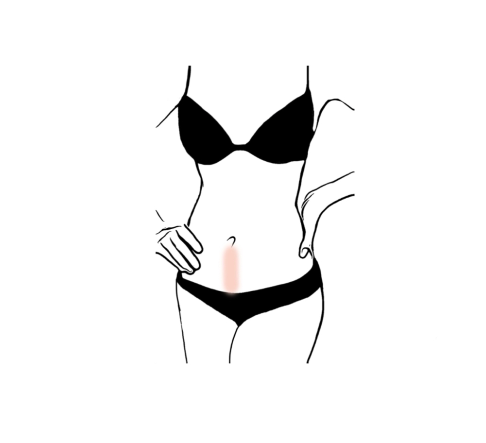 Belly Strip