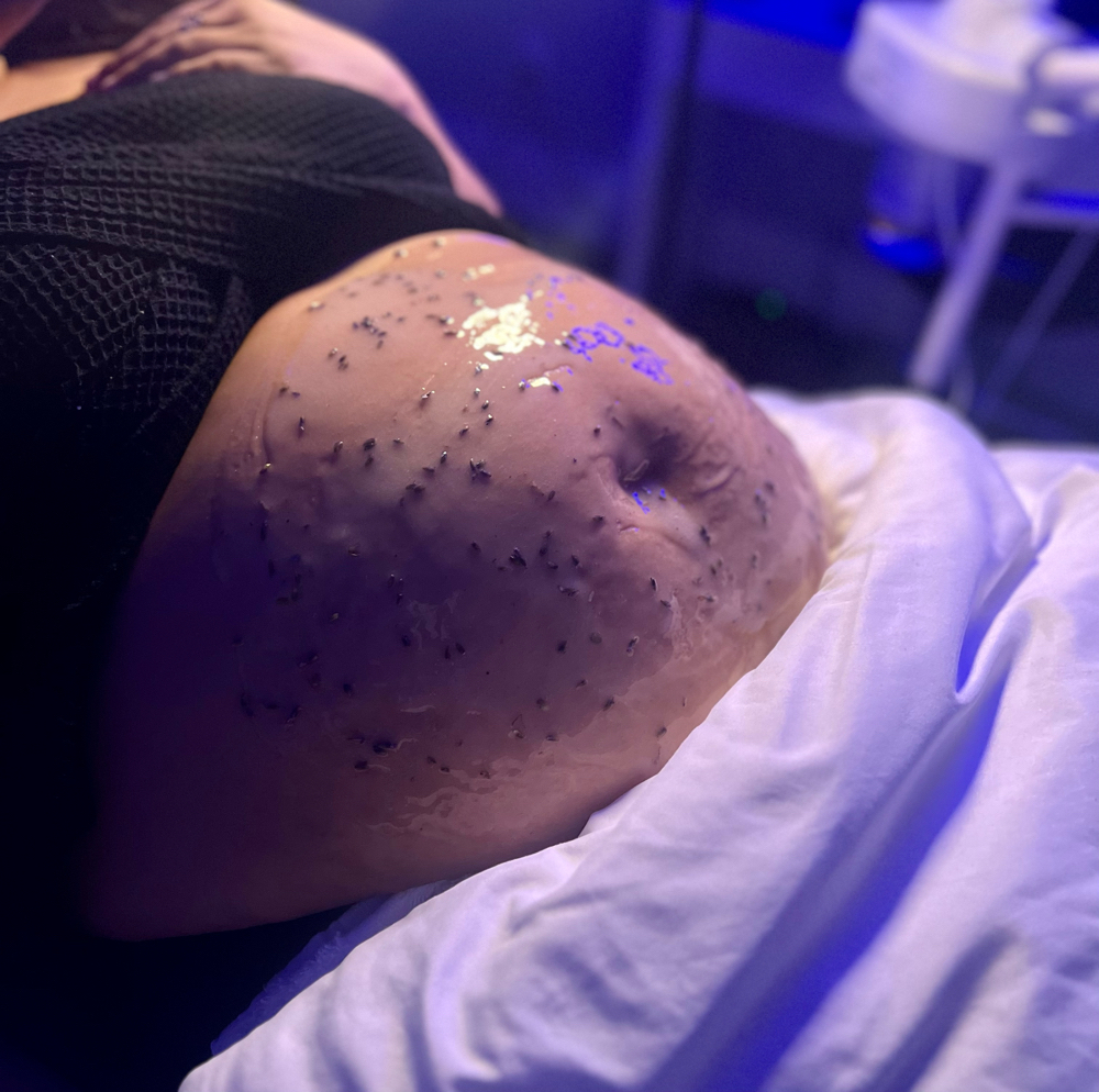 Maternity Belly Facial