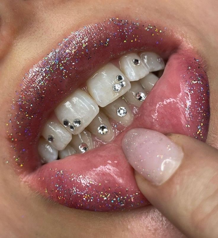 Tooth Gem Freestyle