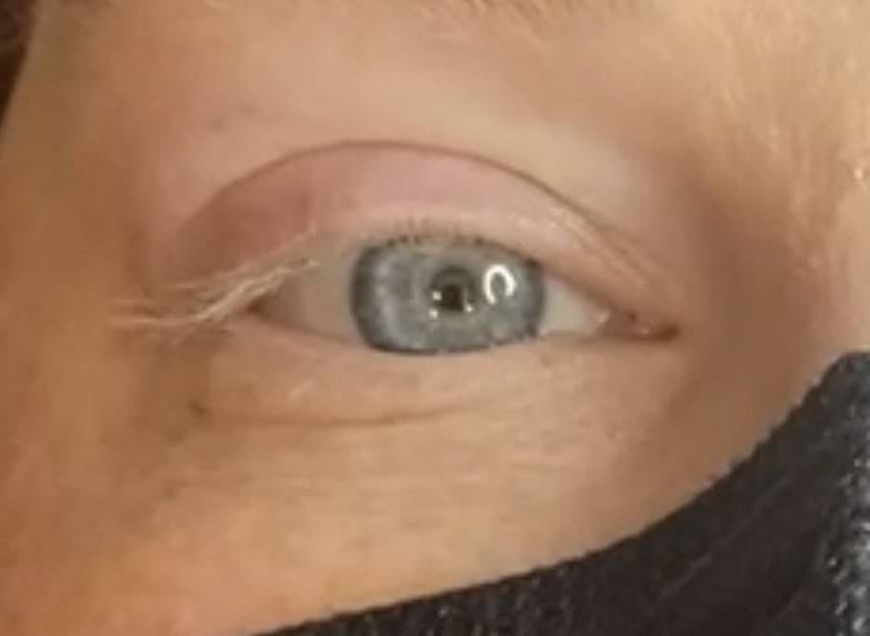Lash Removal